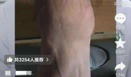 脚崴了视频,了解崴脚瞬间及康复过程